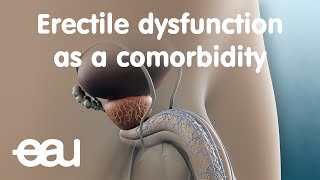Erectile dysfunction as a comorbidity