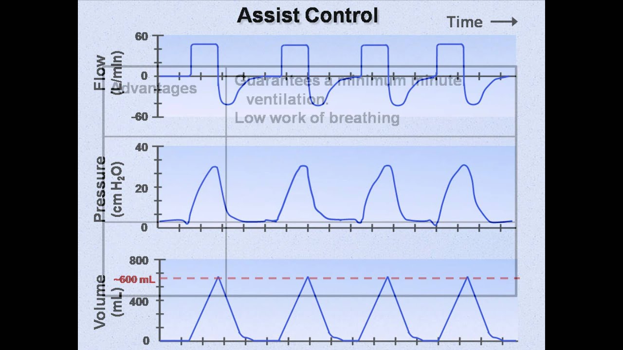 Mechanical Ventilation Manual Basic Modes Of Mechanical, 43% OFF