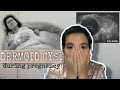 Ovarian Dermoid Cyst during pregnancy || My Journey by saify TeeVee