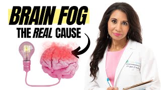 Why Do I Have Brain Fog? Brain Fog 101