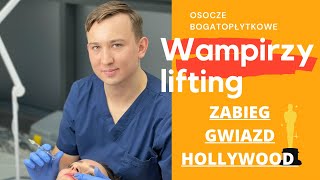 Wampirzy lifting - zabieg gwiazd Hollywood