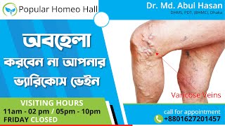 ভ্যারিকোস ভেইন | Varicose vein এর কারণ, লক্ষণ ও চিকিৎসা !