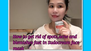 How to get rid of spots,acne and blemishes fast Sudocrem face mask/Skincare/Beautytips/Ofwsadubai