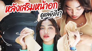 ชีวิตเนสตี้ หลังมีหน้าอก แบบใหม่แบบสับ!! กับตัวช่วยสุดปัง