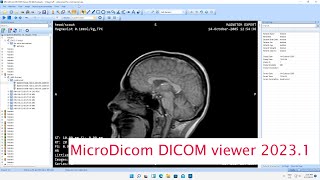 MicroDicom DICOM Viewer 2023.1