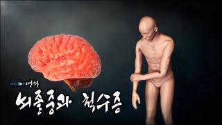 [명의 의학백과📖] 뇌졸중과 척수증