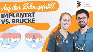 Implantat oder Brücke - Vor- \u0026 Nachteile, Kosten, Was brauche ich?