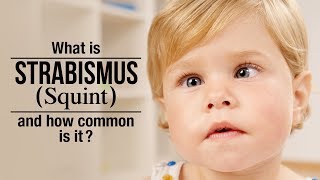 Strabismus in Kids - Cause and Treatment | Squint in Kids