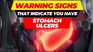 top 10 warning signs of stomach ulcers