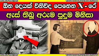 ඕන දෙයක් විනිවිද පෙනෙන X - රේ ඇස්‌ තිබූ අරුම පුදුම මිනිසා