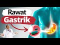 YAKUMI, sakit gastrik bukan lagi risau