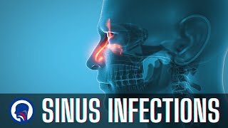 Understanding Sinus Infections | Capital ENT & Sinus Center