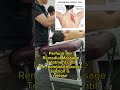 remedial massage理疗按摩～brandon tan