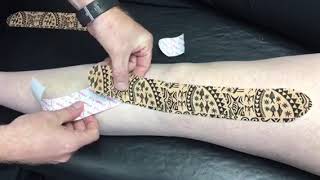 Dynamic Tape Demonstration for Anterior Knee Pain | Pro Physio