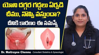 యోని దగ్గర గడ్డలు, నొప్పి వస్తుందా? | Bartholin Cyst In Telugu | Uterus Problems | Sankhya Hospitals