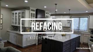 Refacing Before and After