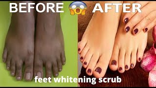 #Feetcare#softfeetBest Feet Care Remove Dullness And Dry Skin | Feet Whitening | #beauty#howto