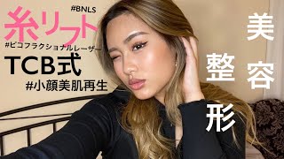 【糸リフト/美容整形】ダウンタイム経過動画、カウンセリング動画！！