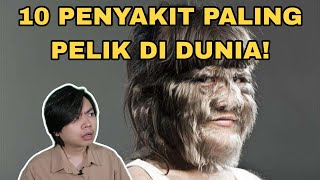 10 Penyakit Paling Pelik Di Dunia!