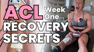 ACL SURGERY RECOVERY SECRETS - Week One Post Anterior Cruciate Ligament Surgery