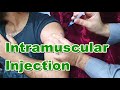 Intramuscular Injection Site & Technique in Deltoid (Shoulder) and Gluteal Region (Buttocks) | IM