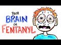 Your Brain On Fentanyl (FIXED)