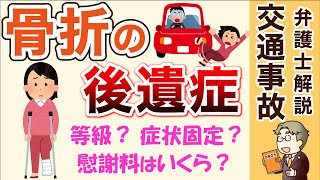 【交通事故の骨折】後遺症の慰謝料の相場は？後遺障害等級は？示談金の交渉方法は？弁護士が詳しく解説します！