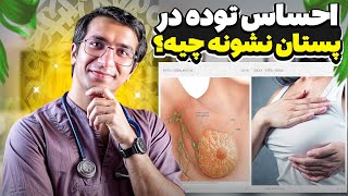 احساس توده در پستان نشونه چیه؟