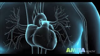 Coronary Angiography & Cardiac Catheterization — AMITA Health