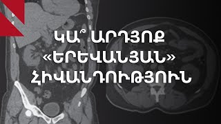 «Երևանյան» հիվանդություն․ միֆ և իրականություն