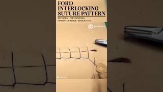 Ford Interlocking Suture Pattern (Lock Stitch) #shorts #medical #suture #suturing #training