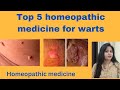 Top 5 homeopathic medicine for warts !! Warts symptoms,causes & treatment ( in hindi )