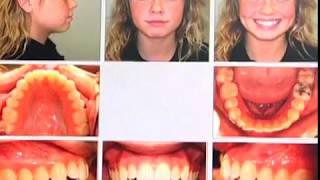 Kentucky Orthodontics \u0026 Invisalign: Records