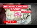 MAKING AN UPPER PARTIAL DENTURE ON METAL FRAMEWORK WITHOUT ARTICULATOR (ALL THE STEPS) IN 4K #WAXBAE