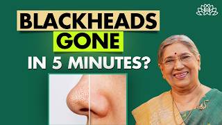 How to Remove Blackheads Permanently | Best Skincare Tips | Dr Hansaji
