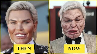 15 Celebrity Plastic Surgery Disasters You’d Never Recognize Today | Then and Now 2026