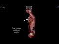 PSMA PET/CT F-18 Pylarify Case 7