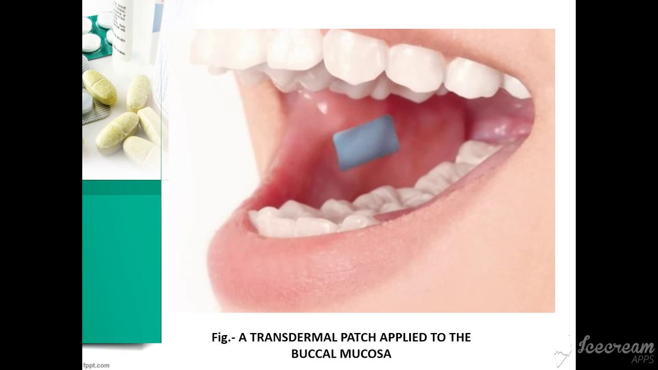 Buccal Drug Delivery System- BDDS - YouTube