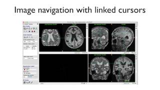 RSNA 2016 ITK-SNAP Training - Manual Segmentation (no audio)