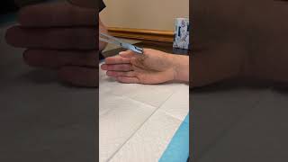 Surgical pins get removed from hand (No blood or gore)