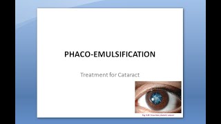 Ophthalmology 212 a PhacoEmulsification Surgery Extra Capsular Cataract Extraction