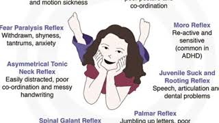 Reflex Integration exercises for Fear Paralysis, TLR, Spinal Galant, ATNR & STNR