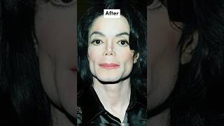 Celebrities Before And After Plastic Surgery 🔥🔥pt2 #shorts #viral