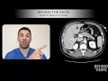 Behind the Knife: How to Read a CT Scan