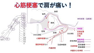 国試対策:暗記からの卒業 61話 関連痛