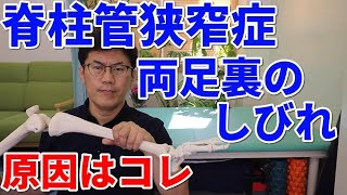 脊柱管狭窄症であなたの両足のしびれの原因と解消法について徹底的に解説します。　　代々木上原整体