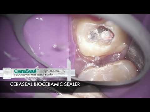 What shrinkage do bioceramic sealers exhibit?