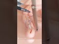 Laparoscopic Suturing Techniques