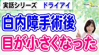 白内障手術後目が小さくなったお悩み解決！即効果出るポイント解説！