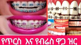 የጥርስ  እና የብሬስ ዋጋ ዝር ዝር በኢትዮና በሳኡዲ  Ethiopian, 2023